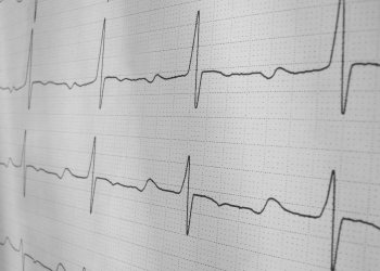 stress test bitpico Bitcoin Cash