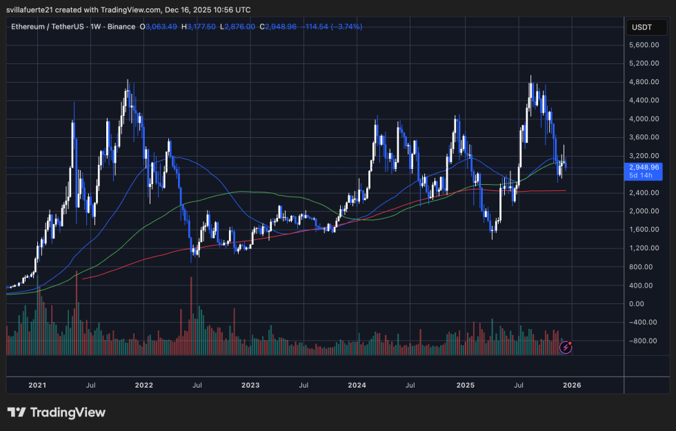 ETH consolidates around critical support level | Source: ETHUSDT chart on TradingView