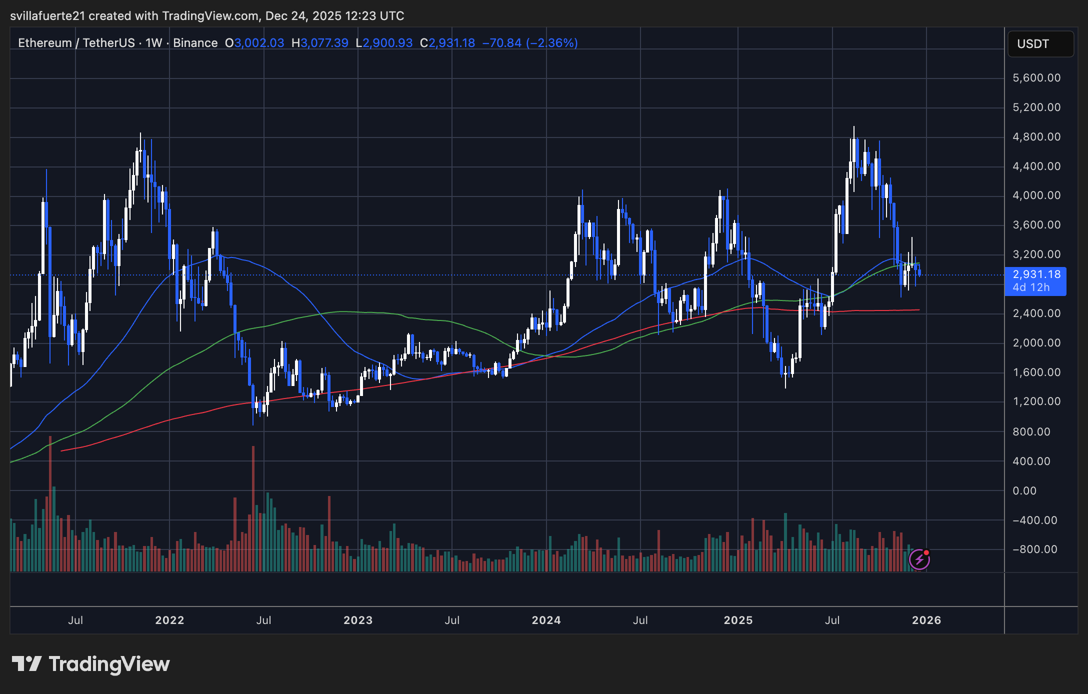 Ethereum consolidates around critical demand level | Source: ETHUSDT chart on TradingView
